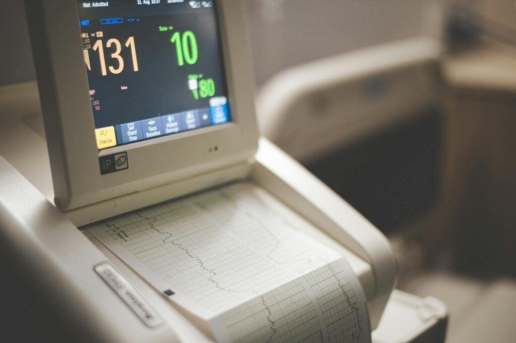 Close-up shot of a medical ECG monitor displaying heart rate and oxygen levels, essential for patient monitoring.