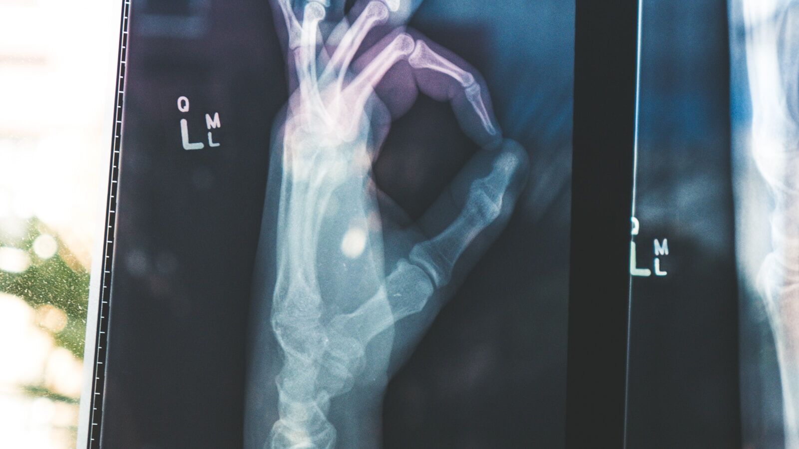 Advanced Imaging Technologies Improving Elderly Care Today